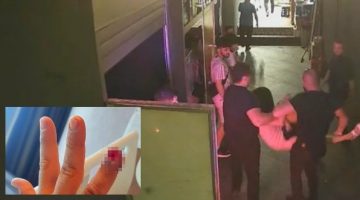 Özel Güvenlik görevlisinin parmağını ısırıp koparan kadının 4,5 yıl hapsi istendi