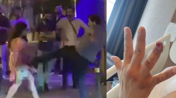 Özel güvenliğin parmağını koparan kadına ilk duruşmada tahliye