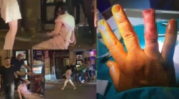 Tartıştığı güvenlik görevlisinin parmağını ısırarak koparan kadının cezası belli oldu