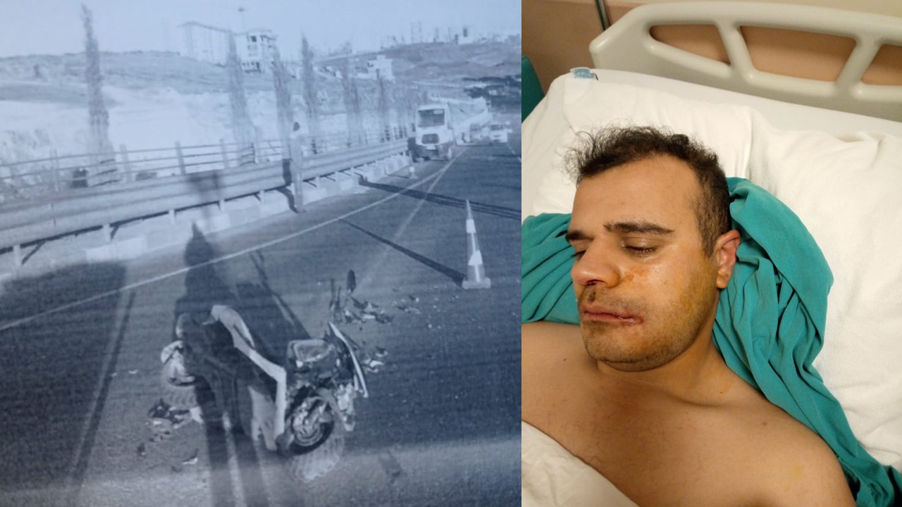 Kendisine Çarpan Aracı Arıyor