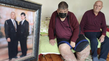 Sivrisinek, özel güvenlik görevlisinin hayatını kararttı